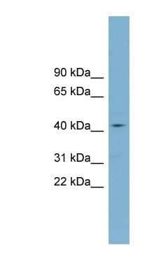 Western Blot: ZDHHC18 Antibody [NBP1-60124] - OVCAR-3 cell lysate, concentration 0.2-1 ug/ml.