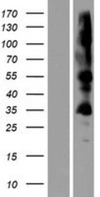 Western Blot: ZDHHC19 Overexpression Lysate (Adult Normal) [NBP2-08581] Left-Empty vector transfected control cell lysate (HEK293 cell lysate); Right -Over-expression Lysate for ZDHHC19.