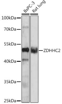Western Blot: ZDHHC2 Antibody [NBP2-93085] - Analysis of extracts of various cell lines, using ZDHHC2 . Exposure time: 90s.