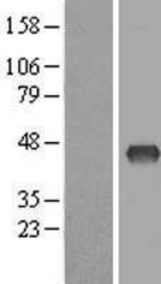 Western Blot: ZDHHC2 Overexpression Lysate (Adult Normal) [NBL1-18004] Left-Empty vector transfected control cell lysate (HEK293 cell lysate); Right -Over-expression Lysate for ZDHHC2.