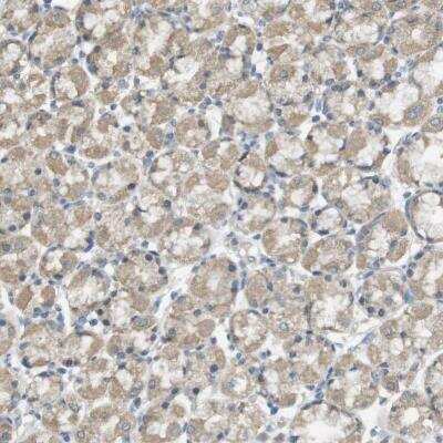 Immunohistochemistry-Paraffin: ZDHHC20 Antibody [NBP1-82046] - Staining of human stomach shows cytoplasmic positivity in glandular cells.