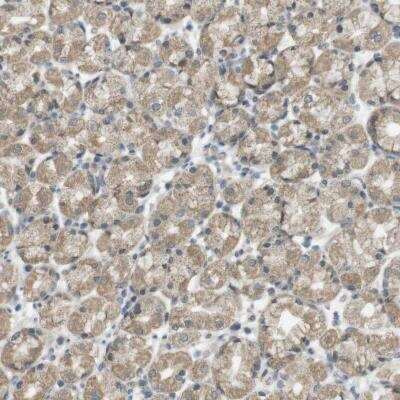 Immunohistochemistry-Paraffin: ZDHHC20 Antibody [NBP1-82047] - Staining of human stomach shows cytoplasmic positivity in glandular cells.