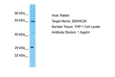 Western Blot: ZDHHC20 Antibody [NBP2-86409] - Host: Rabbit. Target Name: ZDHHC20. Sample Type: THP-1 Whole cell lysates. Antibody Dilution: 1.0ug/ml