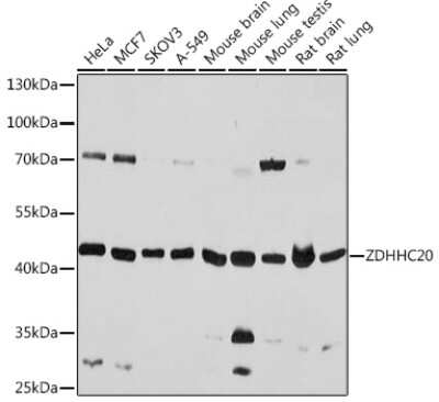 Western Blot ZDHHC20 Antibody - Azide and BSA Free