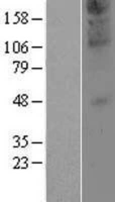Western Blot: ZDHHC21 Overexpression Lysate (Adult Normal) [NBP2-04950] Left-Empty vector transfected control cell lysate (HEK293 cell lysate); Right -Over-expression Lysate for ZDHHC21.