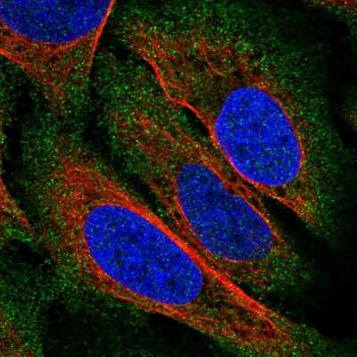 Immunocytochemistry/ Immunofluorescence ZDHHC22 Antibody