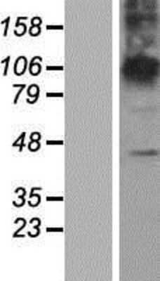 Western Blot ZDHHC23 Overexpression Lysate