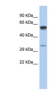 Western Blot: ZDHHC24 Antibody [NBP1-62198] - Titration: 0.2-1 ug/ml, Positive Control: Human Small Intestine.