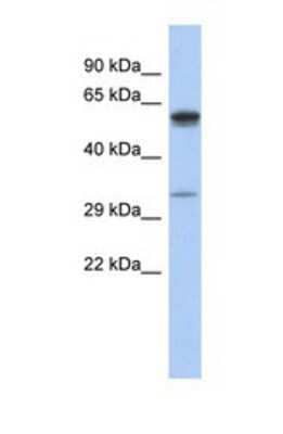 Western Blot: ZDHHC24 Antibody [NBP1-69239] - This Anti-ZDHHC24 antibody was used in Western Blot of Fetal Small Intestine tissue lysate at a concentration of 1ug/ml.