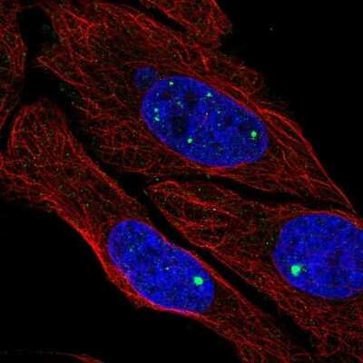 Immunocytochemistry/ Immunofluorescence ZDHHC4 Antibody - BSA Free