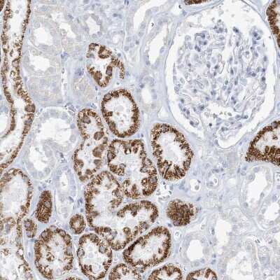 Immunohistochemistry-Paraffin: ZDHHC4 Antibody [NBP1-83858] - Staining of human kidney shows strong cytoplasmic positivity in cells in tubules.