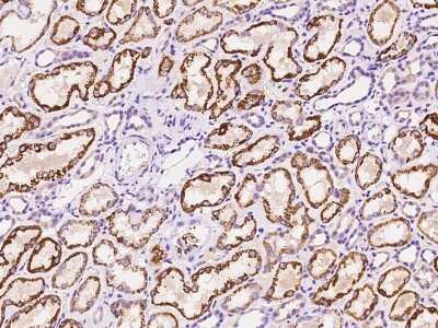 Immunohistochemistry-Paraffin ZDHHC4 Antibody - BSA Free
