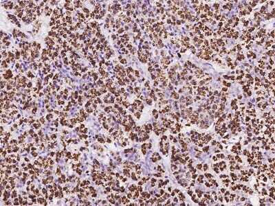 Immunohistochemistry-Paraffin ZDHHC4 Antibody - BSA Free