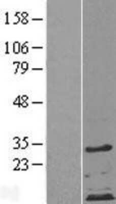 Western Blot: ZDHHC4 Overexpression Lysate (Adult Normal) [NBP2-04368] Left-Empty vector transfected control cell lysate (HEK293 cell lysate); Right -Over-expression Lysate for ZDHHC4.