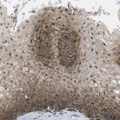 Immunohistochemistry-Paraffin: ZDHHC5 Antibody [NBP1-81376] - Staining of human esophagus shows membranous positivity in squamous epithelial cells.