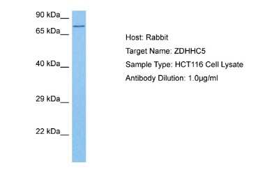 Western Blot: ZDHHC5 Antibody [NBP2-83796] - Host: Rabbit. Target Name: ZDHHC5. Sample Tissue: Human HCT116 Whole Cell lysates. Antibody Dilution: 1ug/ml