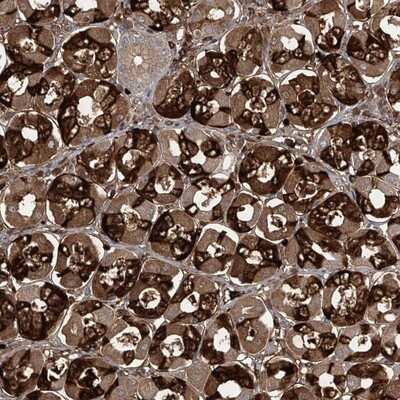 Immunohistochemistry-Paraffin: ZDHHC9 Antibody [NBP1-84499] - Staining of human stomach shows strong cytoplasmic positivity in glandular cells.