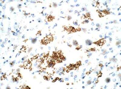 Immunohistochemistry-Paraffin ZDHHC9 Antibody