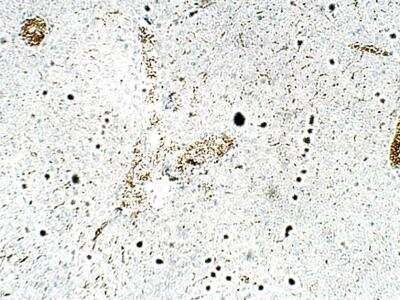 Immunohistochemistry-Paraffin ZDHHC9 Antibody