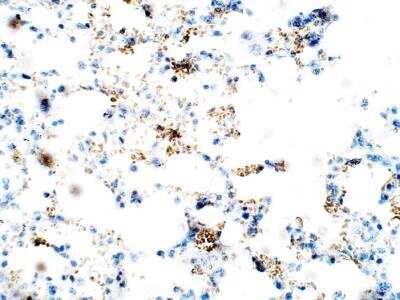 Immunohistochemistry-Paraffin: ZDHHC9 Antibody [NBP3-12368] - Mouse Lung.  1:50 dilution in IHC blocking buffer. DAB (brown) staining and Hematoxylin QS (blue) counterstain. 40x magnification.