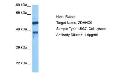 Western Blot: ZDHHC9 Antibody [NBP2-83797] - Host: Rabbit. Target Name: ZDHHC9. Sample Tissue: Human U937 Whole Cell lysates. Antibody Dilution: 1ug/ml