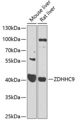 Western Blot: ZDHHC9 Antibody [NBP2-93686] - Analysis of extracts of various cell lines, using ZDHHC9 . Exposure time: 90s.
