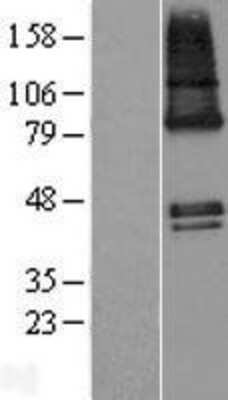Western Blot: ZDHHC9 Overexpression Lysate (Adult Normal) [NBP2-08802] Left-Empty vector transfected control cell lysate (HEK293 cell lysate); Right -Over-expression Lysate for ZDHHC9.