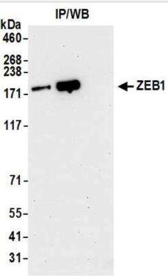 Immunoprecipitation: ZEB1 Antibody [NBP3-14694] - Whole cell lysate (1.0 mgper IP reaction; 20% of IP loaded) from 293T cells preparedusing NETN lysis buffer. Antibodies: Rabbit anti-ZEB1recombinant monoclonal antibody used for IP at 20 ul/mg lysate. ZEB1 was alsoimmunoprecipitated by rabbit anti-ZEB1 antibody. For blotting immunoprecipitated ZEB1,was used at 1:1000. Chemiluminescence withan exposure time of 30 seconds.