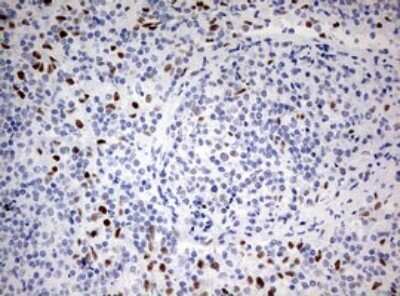 Immunohistochemistry: ZEB1 Antibody (OTI3G6) - Azide and BSA Free [NBP2-74910] - Analysis of Human lymph node tissue. (Heat-induced epitope retrieval by 10mM citric buffer, pH6.0, 120C for 3min)