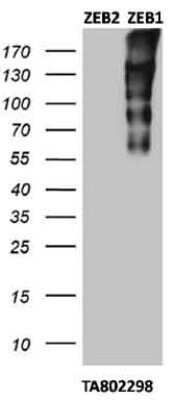 Western Blot: ZEB1 Antibody (OTI3G6) - Azide and BSA Free [NBP2-74910] - Cross-reactivity test with ZEB2: Analysis of HEK293T cells were transfected with plasmids overexpressing either ZEB2 (left) or ZEB1 (right).