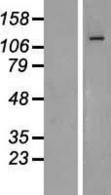 Western Blot ZEB1 Overexpression Lysate