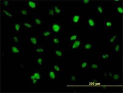Immunocytochemistry/Immunofluorescence: ZEB2 Antibody (2D12) [H00009839-M03] - Analysis of monoclonal antibody to ZFHX1B on HeLa cell. Antibody concentration 10 ug/ml