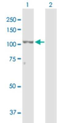 Western Blot: ZEB2 Antibody [H00009839-D01P] - Analysis of ZEB2 expression in transfected 293T cell line by ZEB2 polyclonal antibody.Lane 1: ZEB2 transfected lysate(136.40 KDa).Lane 2: Non-transfected lysate.