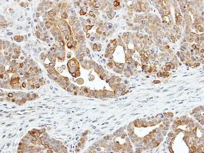 Immunohistochemistry-Paraffin: ZER1 Antibody [NBP1-32801] - Paraffin-embedded NCI-N87 xenograft, using antibody at 1:500 dilution.