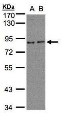 Western Blot: ZER1 Antibody [NBP1-32801] - (30 ug whole cell lysate) A: A431 B: H1299 7.5% SDS PAGE diluted at 1:500