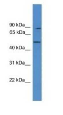 Western Blot: ZER1 Antibody [NBP1-69105] - Titration: 1.0 ug/ml Positive Control: RPMI-8226 Whole Cell.