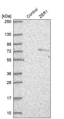 Western Blot: ZER1 Antibody [NBP2-33525] - Analysis in control (vector only transfected HEK293T lysate) and ZER1 over-expression lysate (Co-expressed with a C-terminal myc-DDK tag (~3.1 kDa) in mammalian HEK293T cells).