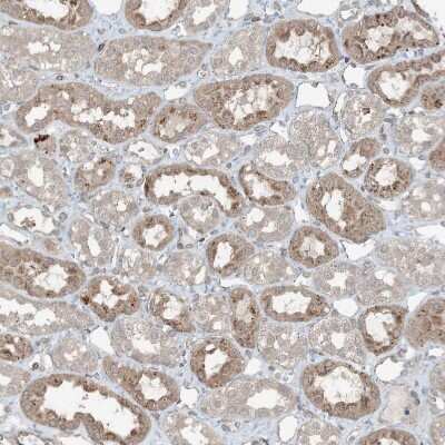 Immunohistochemistry-Paraffin: ZFAND2B Antibody [NBP2-33994] - Staining of human kidney shows moderate granular cytoplasmic positivity in cells in tubules.