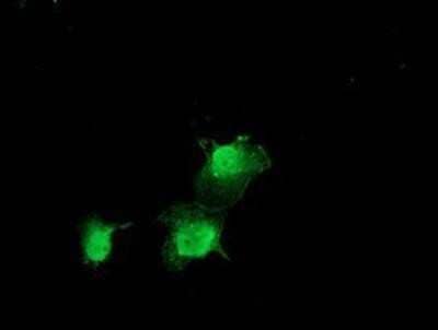 Immunocytochemistry/Immunofluorescence: ZFAND2B Antibody (OTI1G10) - Azide and BSA Free [NBP2-74917] - Staining of COS7 cells transiently transfected by pCMV6-ENTRY ZFAND2B.