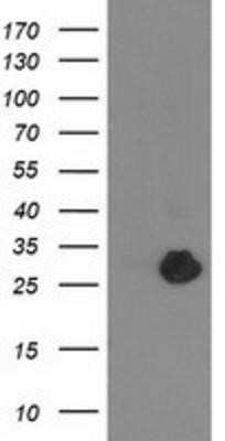 Western Blot: ZFAND2B Antibody (OTI1G10) - Azide and BSA Free [NBP2-74917] - HEK293T cells were transfected with the pCMV6-ENTRY control (Left lane) or pCMV6-ENTRY ZFAND2B (Right lane) cDNA for 48 hrs and lysed. Equivalent amounts of cell lysates (5 ug per lane) were separated by SDS-PAGE and immunoblotted with anti-ZFAND2B.