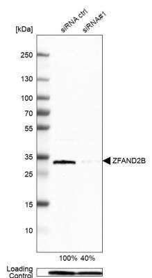 Western Blot: ZFAND2B Antibody [NBP1-89174] - Western blot analysis in Hep-G2 cells transfected with control siRNA, target specific siRNA probe #1. Remaining relative intensity is presented. Loading control: Anti-PPIB.