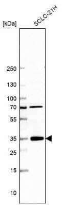 Western Blot: ZFAND2B Antibody [NBP2-33994] - Analysis in human cell line SCLC-21H.