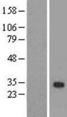 Western Blot: ZFAND2B Overexpression Lysate (Adult Normal) [NBL1-18012] Left-Empty vector transfected control cell lysate (HEK293 cell lysate); Right -Over-expression Lysate for ZFAND2B.