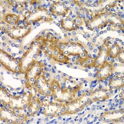 Immunohistochemistry-Paraffin: ZFAND3 Antibody [NBP2-93203] - Paraffin-embedded mouse kidney using ZFAND3 .