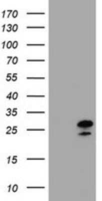Western Blot: ZFAND5 Antibody (5H8) [NBP2-45422] - Analysis of HEK293T cells were transfected with the pCMV6-ENTRY control (Left lane) or pCMV6-ENTRY ZFAND5 .
