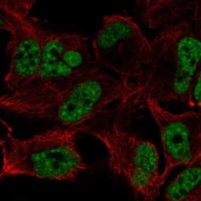 Immunocytochemistry/Immunofluorescence: ZFAND5 Antibody [NBP3-17328] - Staining of human cell line SK-MEL-30 shows localization to nucleoplasm.