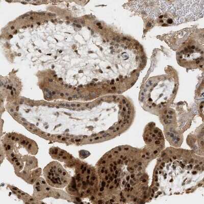 Immunohistochemistry-Paraffin: ZFAND5 Antibody [NBP1-80609] - Staining of human placenta shows strong nuclear positivity in trophoblastic cells.
