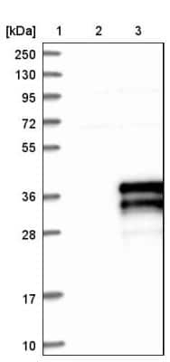 Western Blot: ZFAND5 Antibody [NBP1-80609] - Lane 1: Marker [kDa] 250, 130, 95, 72, 55, 36, 28, 17, 10. Lane 2: Negative control (vector only transfected HEK293T lysate). Lane 3: Over-expression lysate (Co-expressed with a C-terminal myc-DDK tag (3.1 kDa) in mammalian HEK293T cells).