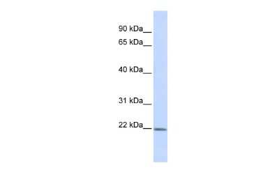 Western Blot: ZFAND5 Antibody [NBP2-86413] - WB Suggested Anti-ZFAND5 Antibody Titration: 0.2-1 ug/ml. ELISA Titer: 1:62500. Positive Control: HepG2 cell lysate