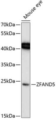 Western Blot: ZFAND5 Antibody [NBP2-93657] - Analysis of extracts of mouse eye, using ZFAND5 .Exposure time: 90s.